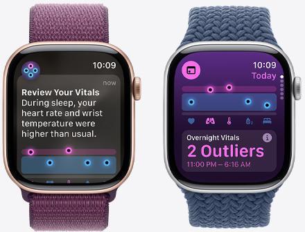 Apple Watch Series 10