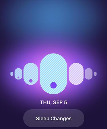Apple Watch Series 10